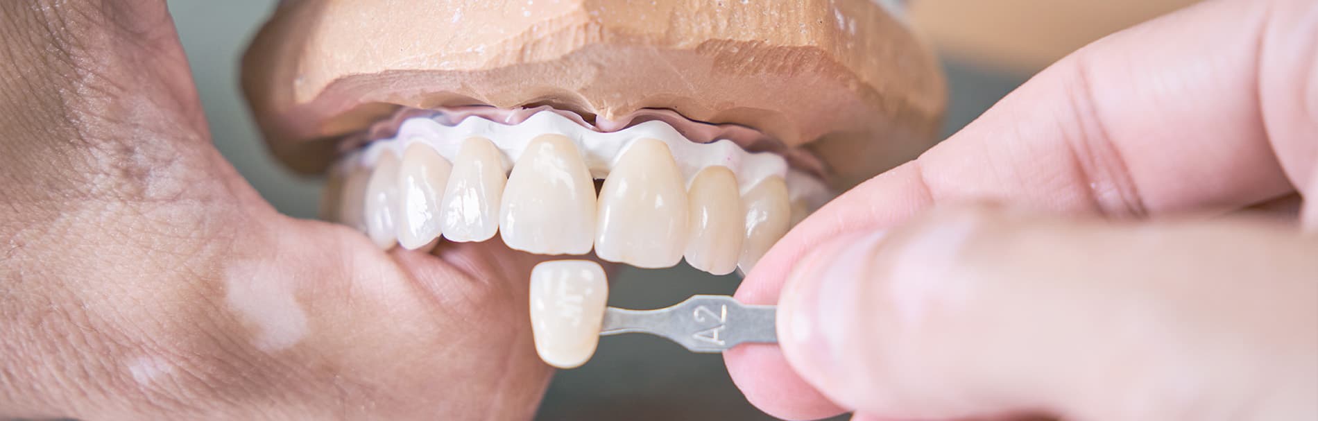 Restauratieve tandheelkunde